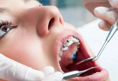 A child getting his teeth checked by an dentist.